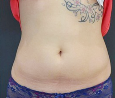 After image