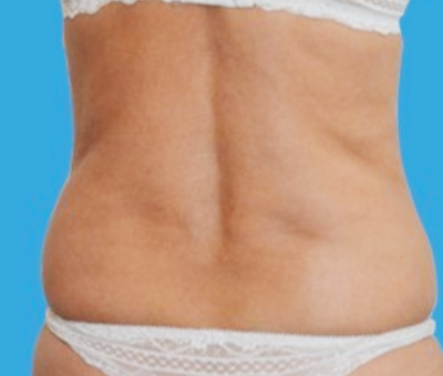 Before image