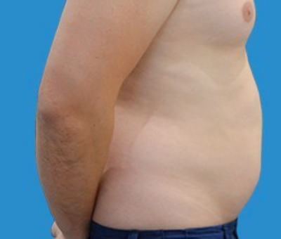 After image