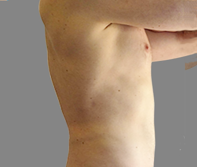 After image