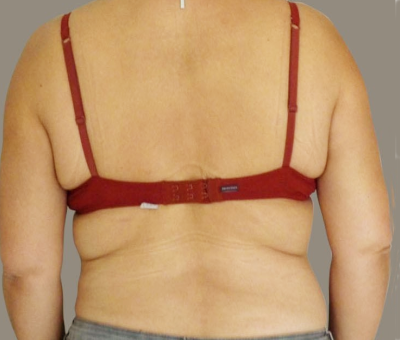 After image