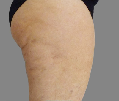 After image