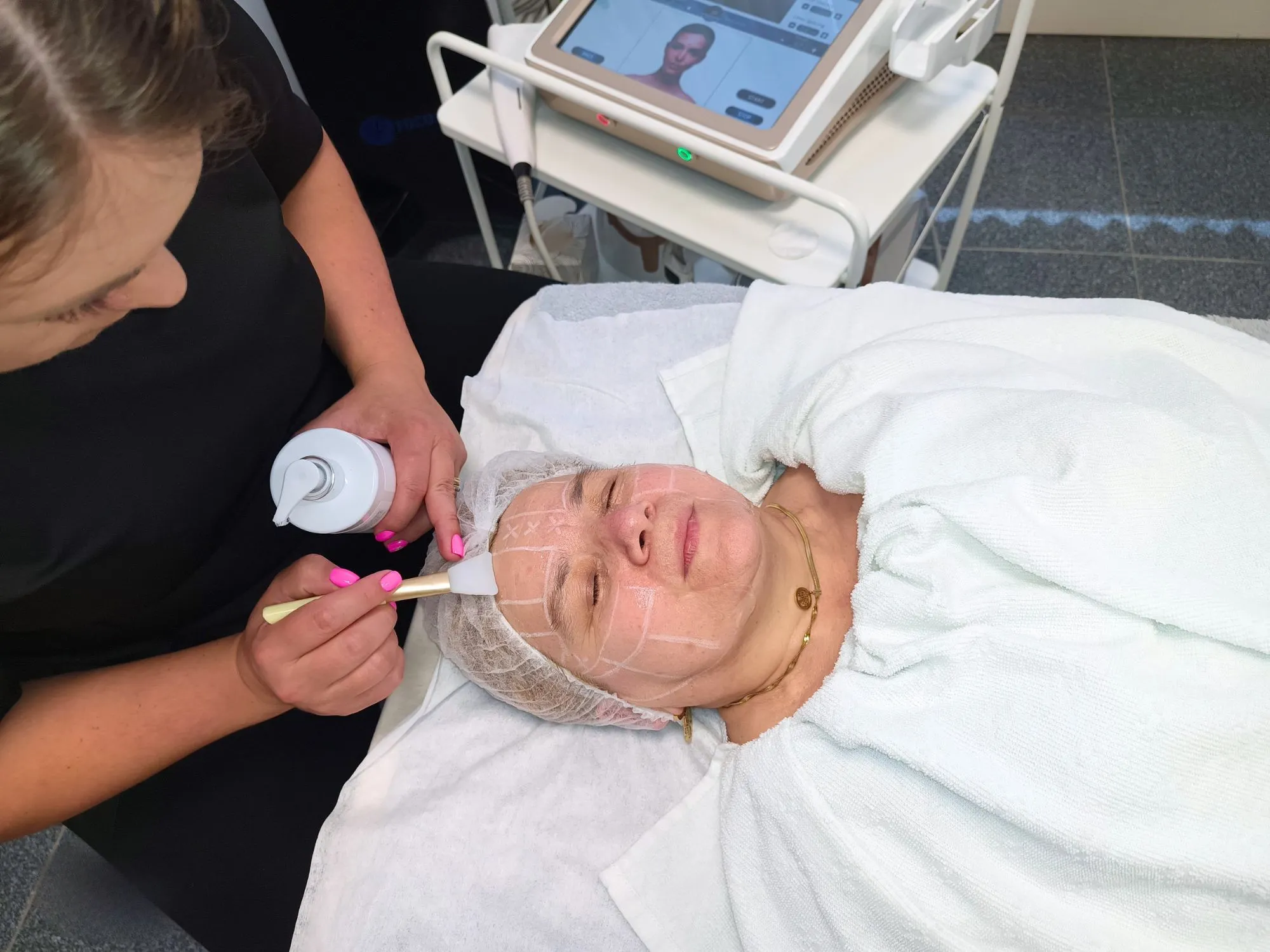 HIFU behandeling met Gold HIFU 7D van MedAes aanbrengen ultrasound gel