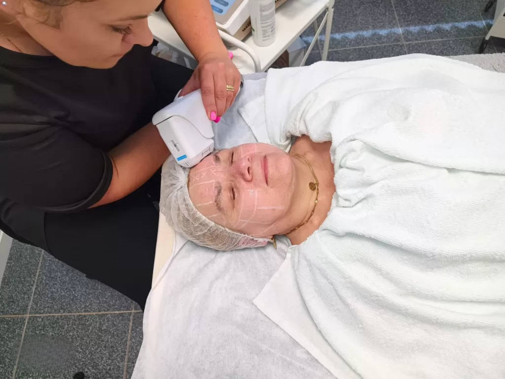 HIFU behandeling met Gold HIFU 7D van MedAes tijdens gezicht lifting behandeling