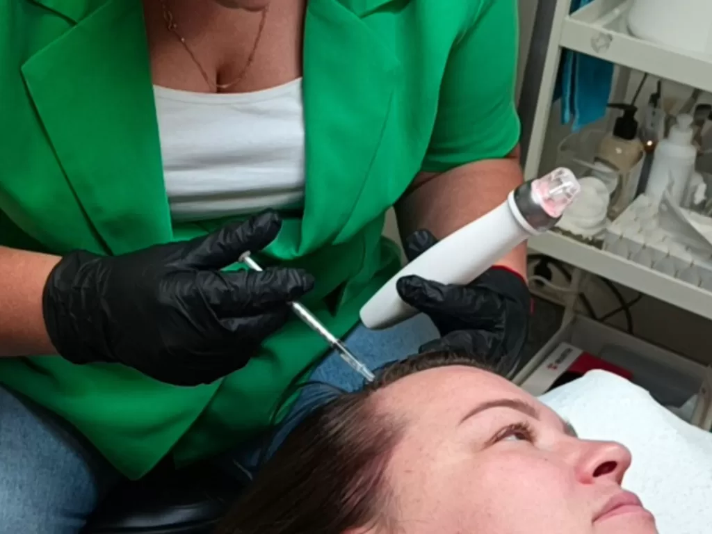 Haaruitval behandeling (Mesotherapie) BioPen Q2 toevoegen Dermelix Max Hair meso