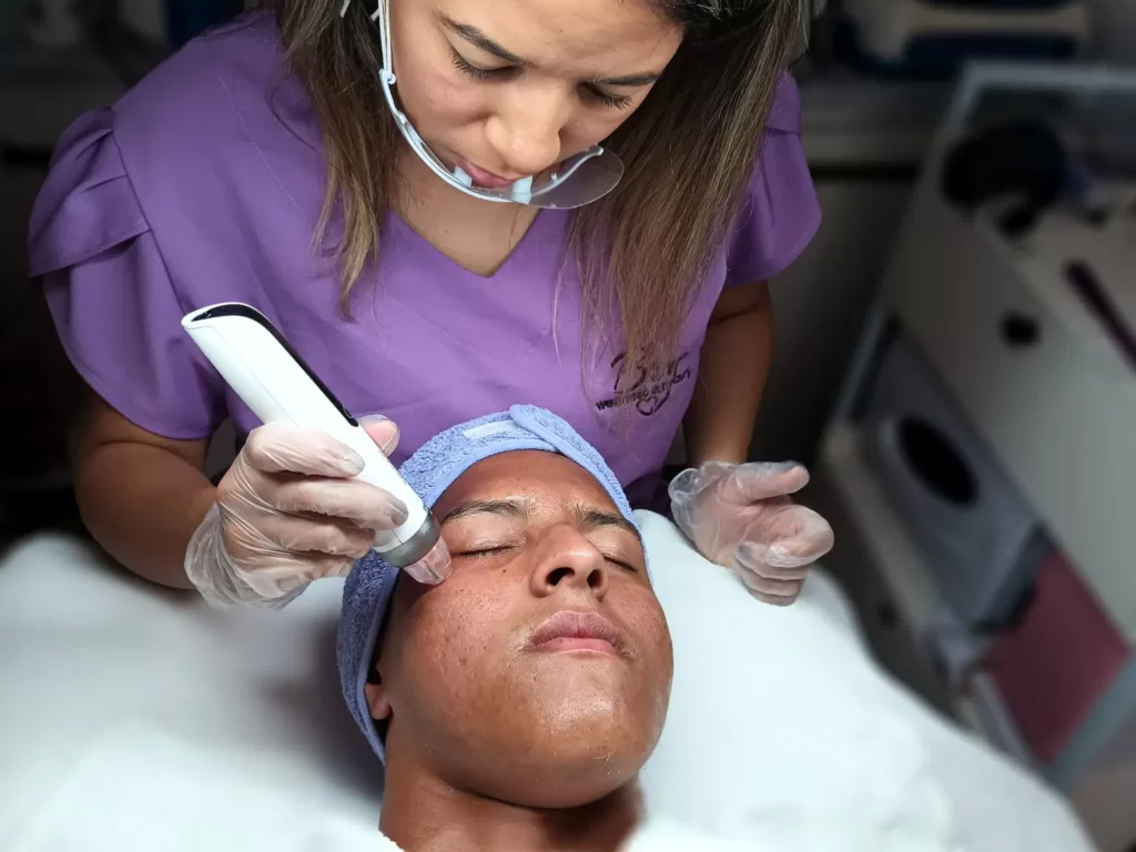 Microneedling behandeling met BioPen Q2 anti-acne behandeling