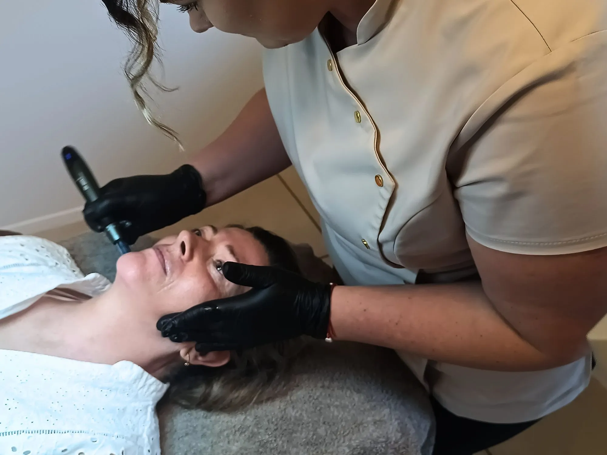 Microneedling behandeling met Dr. Pen A20